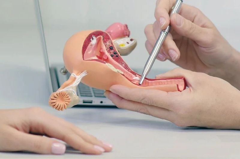 Gynecologic Laparoscopy