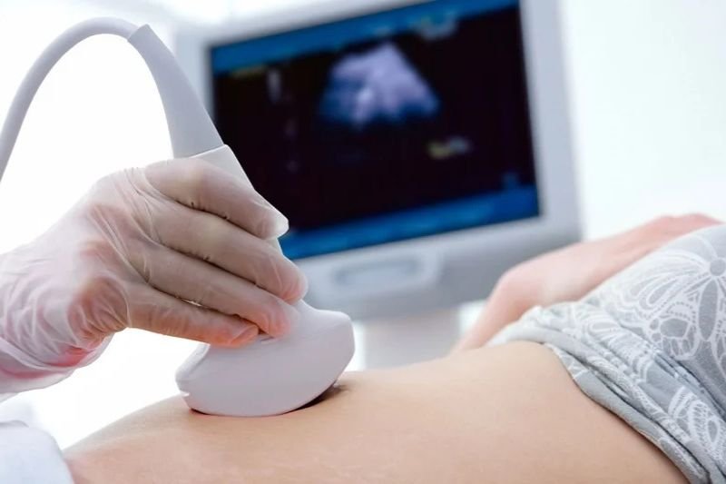 Sonography